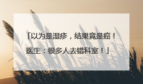 以为是湿疹，结果竟是癌！医生：很多人去错科室！